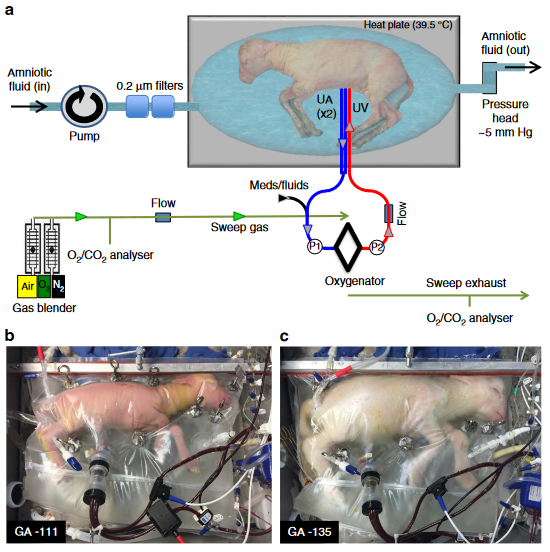 Figure 1 | UA/UV Biobag system design. (a) Circuit and system components consisting of a pumpless, low-resistance oxygenator circuit, a closed fluid environment with continuous fluid exchange and an umbilical vascular interface. (b) Representative lamb cannulated at 107 days of gestation and on day 4 of support. (c) The same lamb on day 28 of support illustrating somatic growth and maturation.