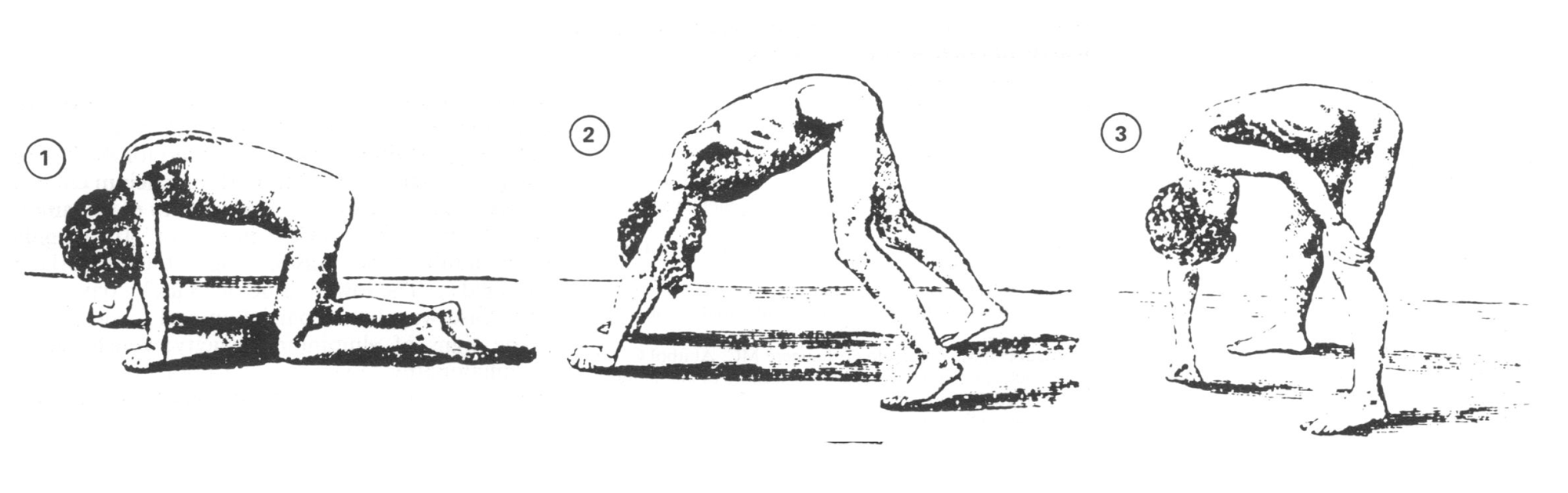 A hallmark of DMD is Gower’s sign, the inability to stand up from a squat with only the hip and leg muscles